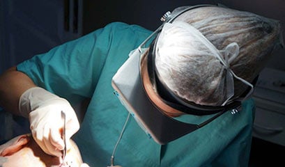 Hair transplant extraction Dr Beyhan