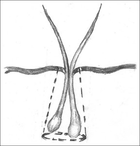 extraction_diagrame