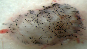 Bulbes obtenus depuis des cellules souches