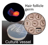 Bouillon culture dimethylpolysiloxane germe follicule pileux