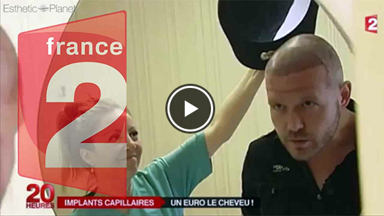 reportage france 2 greffe cheveux turquie dr beyhan zeybek tourisme medical